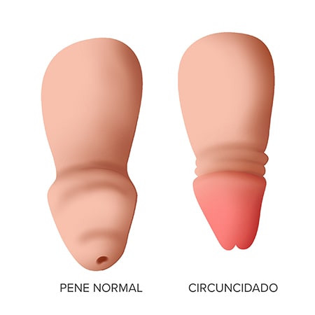 Circuncisión y sexo Afecta tener el pene circuncidado